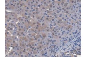 DAB staining on IHC-P; Samples: Mouse Ovary Tissue (ENOX2 anticorps  (AA 1-207))