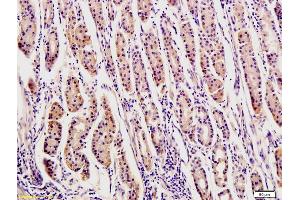 Formalin-fixed and paraffin-embedded human stomach tissue labeled with Rabbit Anti-OPN Polyclonal Antibody, Unconjugated (ABIN723695) at 1:200 followed by conjugation to the secondary antibody and DAB staining