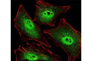 Fluorescent image of A549 cells stained with SIRT1 antibody. (SIRT1 anticorps  (AA 566-601))