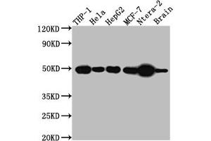Western Blot Positive WB detected in: THP-1 whole cell lysate, Hela whole cell lysate, HepG2 whole cell lysate, MCF-7 whole cell lysate, Ntera-2 whole cell lysate, Mouse Brain whole cell lysate All lanes: TACR1 antibody at 1:1000 Secondary Goat polyclonal to rabbit IgG at 1/50000 dilution Predicted band size: 47, 36 kDa Observed band size: 50 kDa (Recombinant TACR1 anticorps)