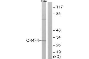 Western blot analysis of extracts from HeLa cells, using OR4F4 antibody. (OR4F4 anticorps  (C-Term))