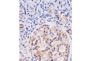 A staining HHLA2 in human pancreas tissue sections by Immunohistochemistry (IHC-P - paraformaldehyde-fixed, paraffin-embedded sections).