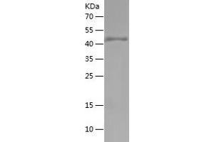 Western Blotting (WB) image for Occludin (OCLN) (AA 270-441) protein (His-IF2DI Tag) (ABIN7124251)