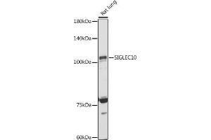 Western blot analysis of extracts of Rat lung, using SIGLEC10 antibody (ABIN7270292) at 1:1000 dilution. (SIGLEC10 anticorps)