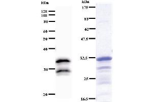 Left: VAX2 staining. (VAX2 anticorps)