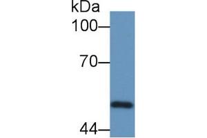 Detection of PSMC4 in Porcine Skeletal muscle lysate using Polyclonal Antibody to Proteasome 26S Subunit, ATPase 4 (PSMC4)