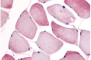 Human Skeletal Muscle (formalin-fixed, paraffin-embedded) stained with CCNL1 antibody ABIN214640 at 10 ug/ml followed by biotinylated goat anti-rabbit IgG secondary antibody ABIN481713, alkaline phosphatase-streptavidin and chromogen. (Cyclin L1 anticorps)