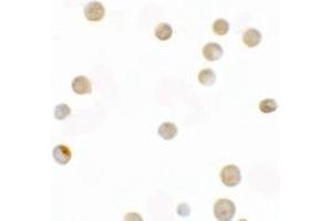 Immunocytochemistry of ZNF521 (NT) in HeLa cells with ZNF521 (NT) antibody at 2.