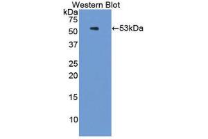 Western Blotting (WB) image for anti-Proteasome (Prosome, Macropain) 26S Subunit, ATPase, 3 (PSMC3) (AA 2-439) antibody (ABIN1860336)