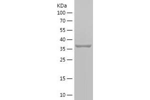 Western Blotting (WB) image for Stomatin (EPB72)-Like 2 (STOML2) (AA 253-356) protein (His-IF2DI Tag) (ABIN7125217) (STOML2 Protein (AA 253-356) (His-IF2DI Tag))
