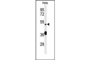 Western blot analysis of DDX49 Antibody (C-term) in Hela cell line lysates (35ug/lane). (DDX49 anticorps  (C-Term))