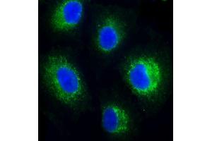 Immunofluorescent analysis of 4 % paraformaldehyde-fixed, 0. (FADS2 anticorps)