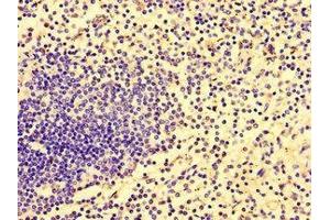 Immunohistochemistry of paraffin-embedded human spleen tissue using ABIN7155534 at dilution of 1:100 (HCP5 anticorps  (AA 8-101))