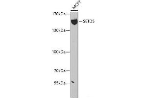 Western blot analysis of extracts of MCF-7 cells using SETD5 Polyclonal Antibody at dilution of 1:300. (SETD5 anticorps)