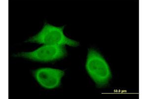 Immunofluorescence of purified MaxPab antibody to CAST on HeLa cell. (Calpastatin anticorps  (AA 1-667))
