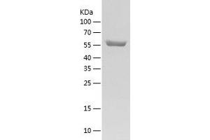 Western Blotting (WB) image for Copine I (CPNE1) (AA 1-537) protein (His-IF2DI Tag) (ABIN7122481)