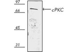 Western blot analysis of human thymus HS67 cell lysate, probed with PKC pAb.