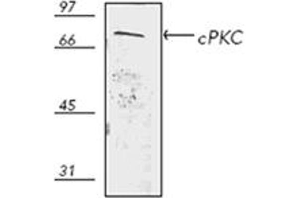 PKC 抗体