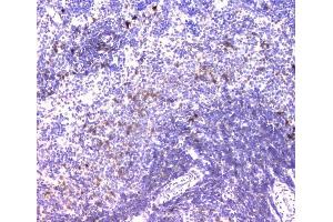 IHC analysis of IGLL1 using anti-IGLL1 antibody (ABIN6719329). (IGLL1 anticorps)