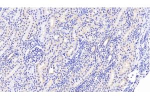 Detection of WWP2 in Human Kidney Tissue using Polyclonal Antibody to WW Domain Containing E3 Ubiquitin Protein Ligase 2 (WWP2)