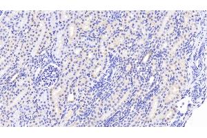 Detection of WWP2 in Human Kidney Tissue using Polyclonal Antibody to WW Domain Containing E3 Ubiquitin Protein Ligase 2 (WWP2) (WWP2 anticorps  (AA 601-870))