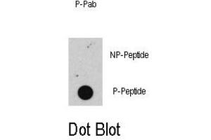 Image no. 1 for anti-Retinoblastoma 1 (RB1) (pSer608) antibody (ABIN358211) (Retinoblastoma 1 anticorps  (pSer608))