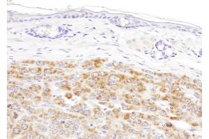 Immunohistochemistry (IHC) image for anti-Isocitrate Dehydrogenase 2 (NADP+), Mitochondrial (IDH2) (AA 402-452) antibody (ABIN7455220)