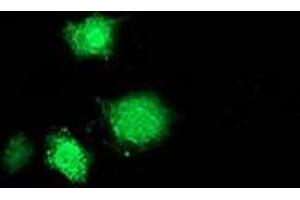 Immunofluorescence (IF) image for anti-Musashi Homolog 1 (Drosophila) (MSI1) antibody (ABIN1499571)