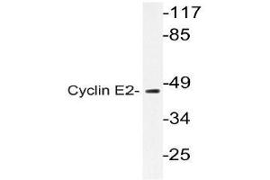 Western blot (WB) analysis of Cyclin E2 antibody in extracts from Jurkat cell. (Cyclin E2 anticorps)