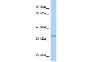 GSTO2 antibody used at 1 ug/ml to detect target protein. (GSTO2 anticorps  (N-Term))