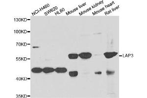 Western blot analysis of extracts of various cell lines, using LAP3 antibody. (LAP3 anticorps)