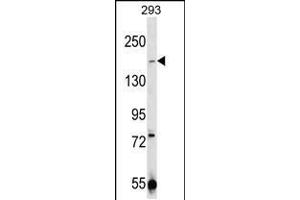 CHAK1 Antibody  (ABIN392614 and ABIN2837991) western blot analysis in 293 cell line lysates (35 μg/lane). (TRPM7 anticorps  (C-Term))