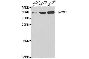 Western blot analysis of extracts of various cell lines, using AZGP1 antibody (ABIN5973101) at 1/1000 dilution.