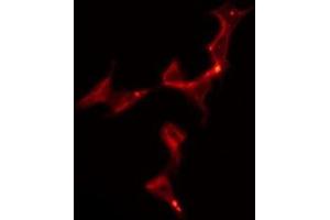 ABIN6275907 staining Hela by IF/ICC. (5HT1B Receptor anticorps  (Internal Region))