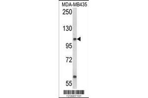 Western blot analysis of CASD1 Antibody in MDA-MB435 cell line lysates (35ug/lane)