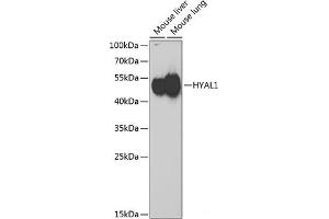 Western blot analysis of extracts of various cell lines using HYAL1 Polyclonal Antibody at dilution of 1:1000. (HYAL1 anticorps)