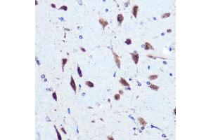 Immunohistochemistry of paraffin-embedded rat brain using hnRNP E2/PCBP2 Rabbit pAb (ABIN3023339, ABIN3023340, ABIN3023341 and ABIN6219620) at dilution of 1:100 (40x lens).