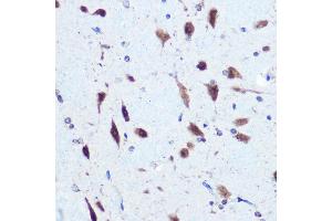 Immunohistochemistry of paraffin-embedded rat brain using hnRNP E2/PCBP2 Rabbit pAb (ABIN3023339, ABIN3023340, ABIN3023341 and ABIN6219620) at dilution of 1:100 (40x lens). (PCBP2 anticorps  (AA 1-130))