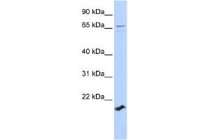 WB Suggested Anti-ZFP37 Antibody Titration:  0. (ZFP37 anticorps  (Middle Region))