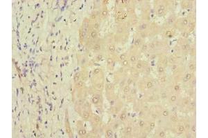 Immunohistochemistry of paraffin-embedded human liver tissue using ABIN7164073 at dilution of 1:100 (PQLC3 anticorps  (AA 118-170))