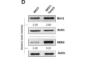 HDAC2 and HDAC5 negatively regulate the expression of miR-125a-5p in ER+ breast cancer cells.