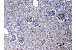 IHC analysis of Crp using anti- Crp antibody .