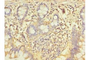 Immunohistochemistry of paraffin-embedded human small intestine tissue using ABIN7148943 at dilution of 1:100 (CCNJL anticorps  (AA 315-435))