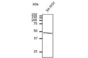 Anti-ATXN3 Ab at 1/500 dilution, Iysates at 100 µg per lane: rabbit polyclonal to goat lgG (HRP) at 1/10,000 dilution, (Ataxin 3 anticorps  (AA 120-250))