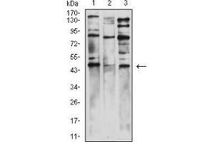 Western blot analysis using WT1 mouse mAb against HEK293 (1), COS7 (2), and PC-3 (3) cell lysate. (WT1 anticorps  (AA 1-181))
