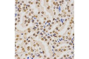 Immunohistochemistry of paraffin-embedded mouse kidney using DiMethyl-Histone H3-K36 antibody.