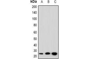 Western blot analysis of SFT2D3 expression in HepG2 (A), NIH3T3 (B), PC12 (C) whole cell lysates. (SFT2D3 anticorps)