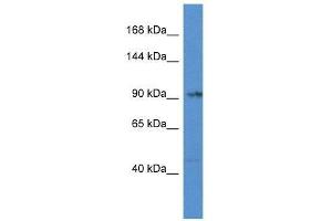 Western Blot showing Tnni3k antibody used at a concentration of 1. (TNNI3K anticorps  (Middle Region))
