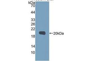 WB of Protein Standard: different control antibodies against Highly purified E.