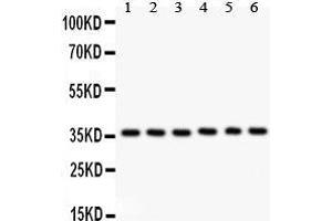 Anti- HMOX2 antibody, Western blotting All lanes: Anti HMOX2  at 0. (HMOX2 anticorps  (AA 2-316))